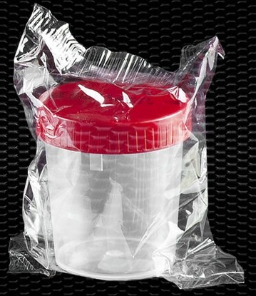 Contenitori per analisi urina sterili